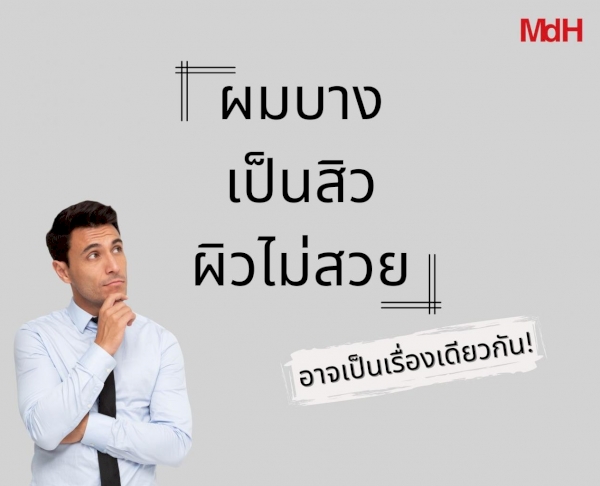 feature-image